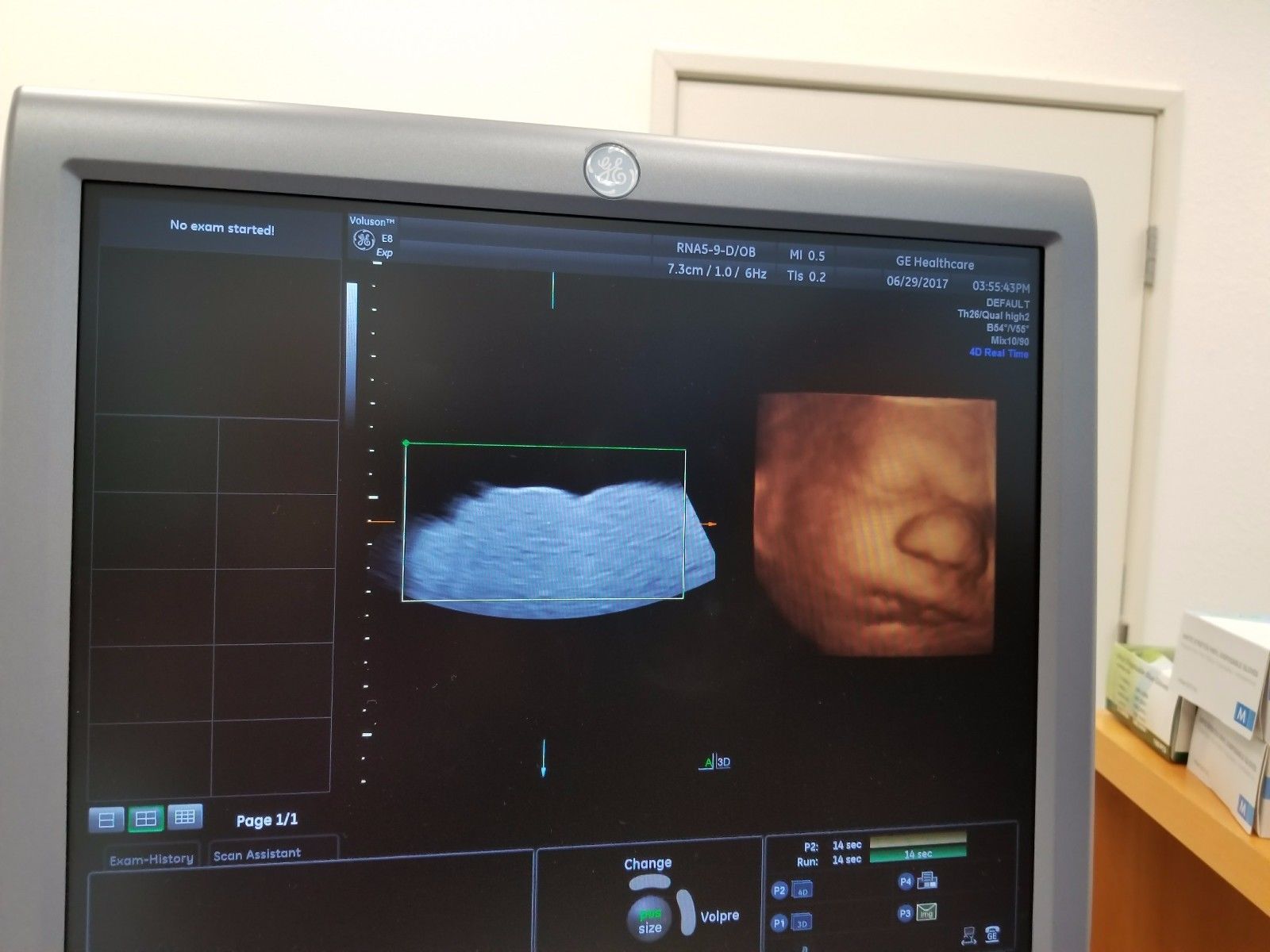 GE RNA5-9-D Ultrasound Probe / Transducer DIAGNOSTIC ULTRASOUND MACHINES FOR SALE