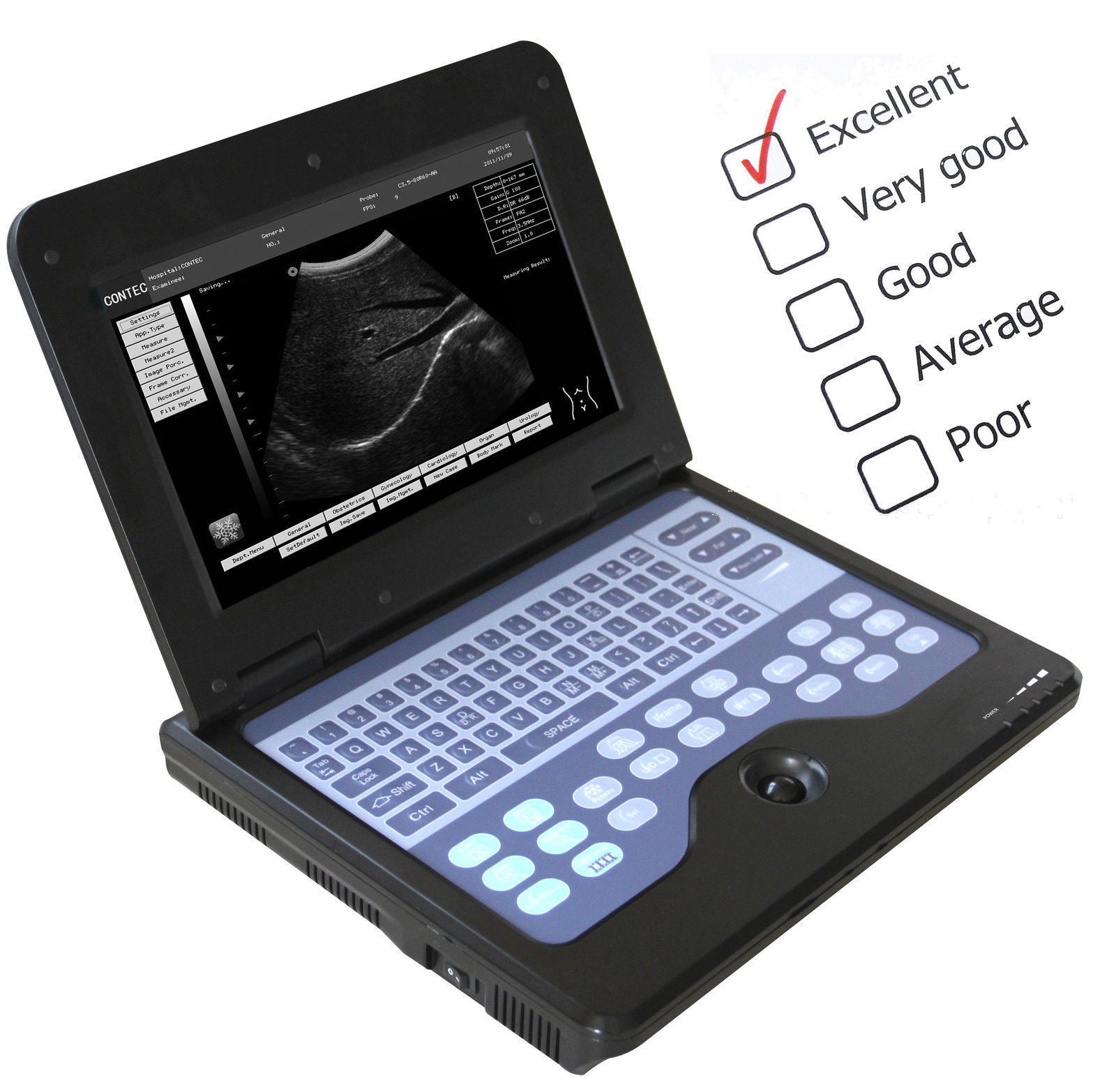 VET Veterinary Ultrasound Scanner For Equine/cows/sheep Rectal +Convex probe,USA 756040906177 DIAGNOSTIC ULTRASOUND MACHINES FOR SALE