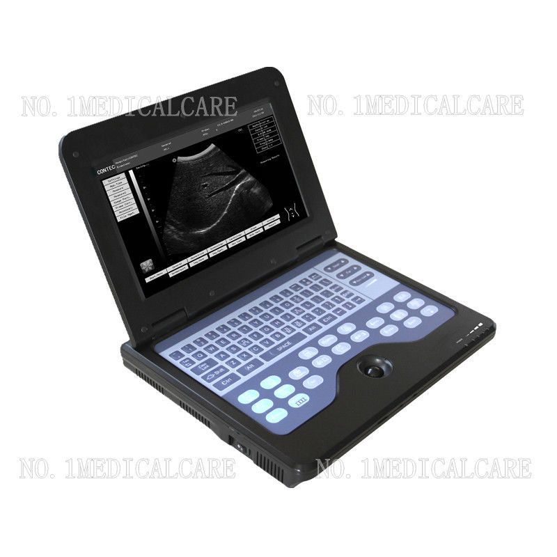 Portable Laptop Machine Digital Ultrasound Scanner, probe, human/vet, USA Fedex DIAGNOSTIC ULTRASOUND MACHINES FOR SALE