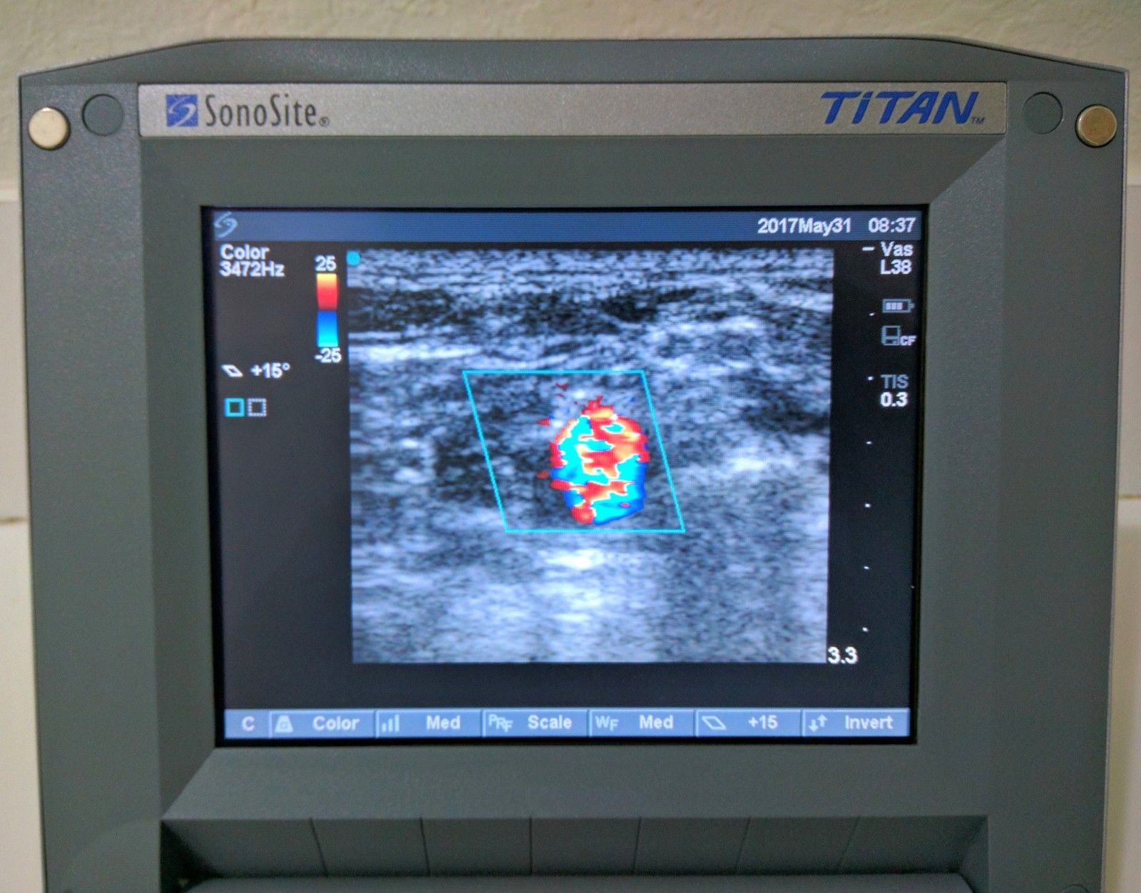 SONOSITE TITAN CV CW W/2 PROBES 1-L38 LINEAR & 1-C15 CURVED ARRAY CARDIAC DIAGNOSTIC ULTRASOUND MACHINES FOR SALE