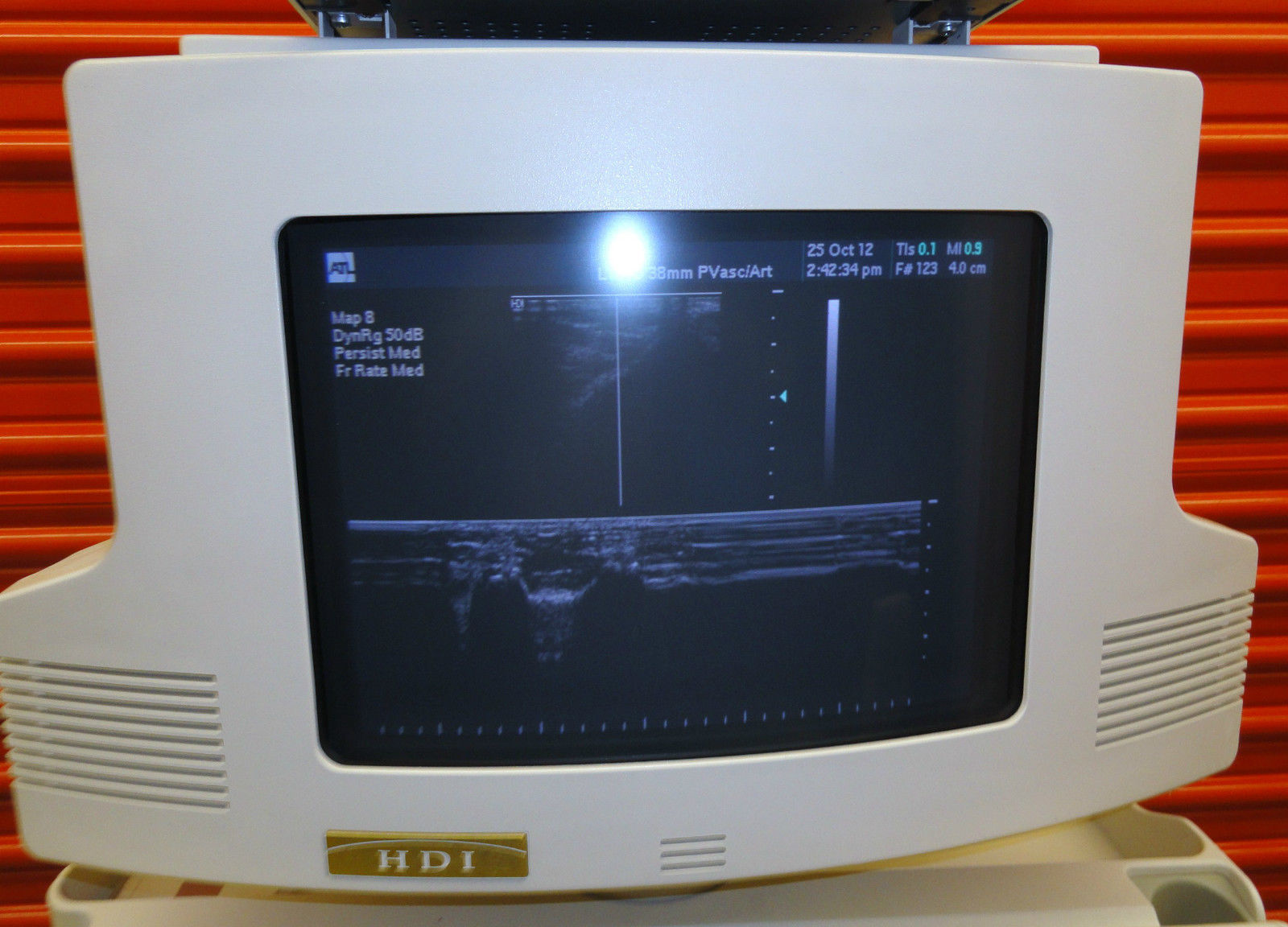 ATL HDI-3000 ULTRASOUND W/ L7-4 & L10-5 VASCUALR-SMALL PARTS PROBES PRINTER &VCR DIAGNOSTIC ULTRASOUND MACHINES FOR SALE