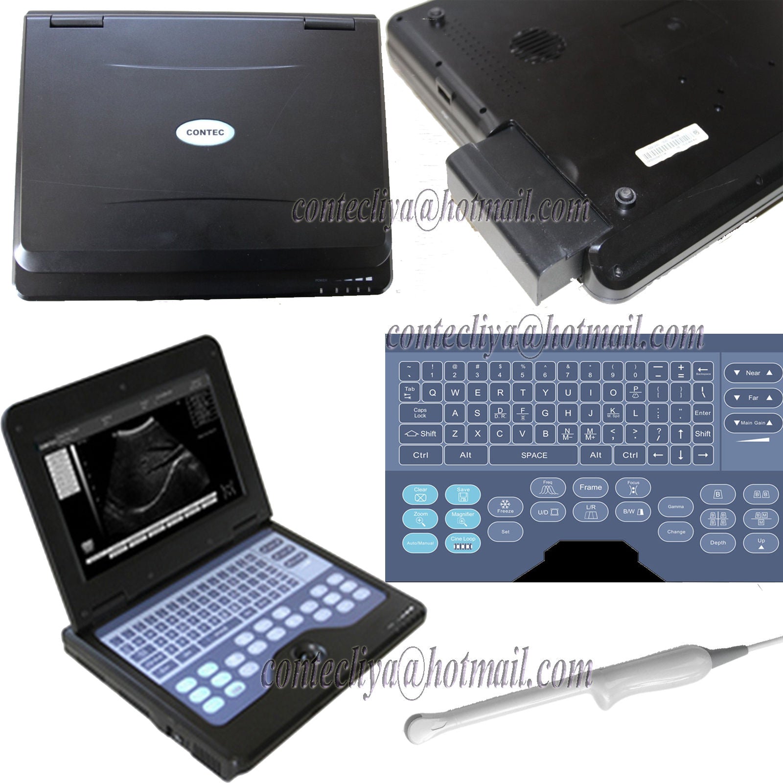 CE Digital Ultrasound Scanner Laptop Machine Diagnostic System Optional 4 Probe DIAGNOSTIC ULTRASOUND MACHINES FOR SALE