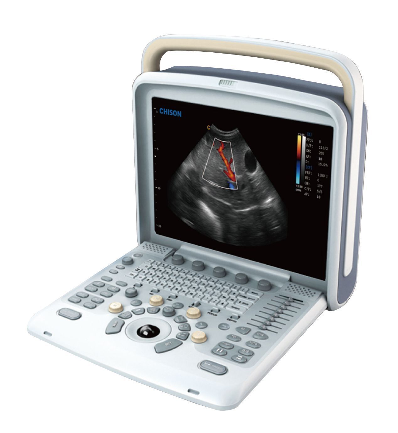 Veterinary Premium Color Doppler Ultrasound Machine - Chison Q5 Vet & One Probe DIAGNOSTIC ULTRASOUND MACHINES FOR SALE