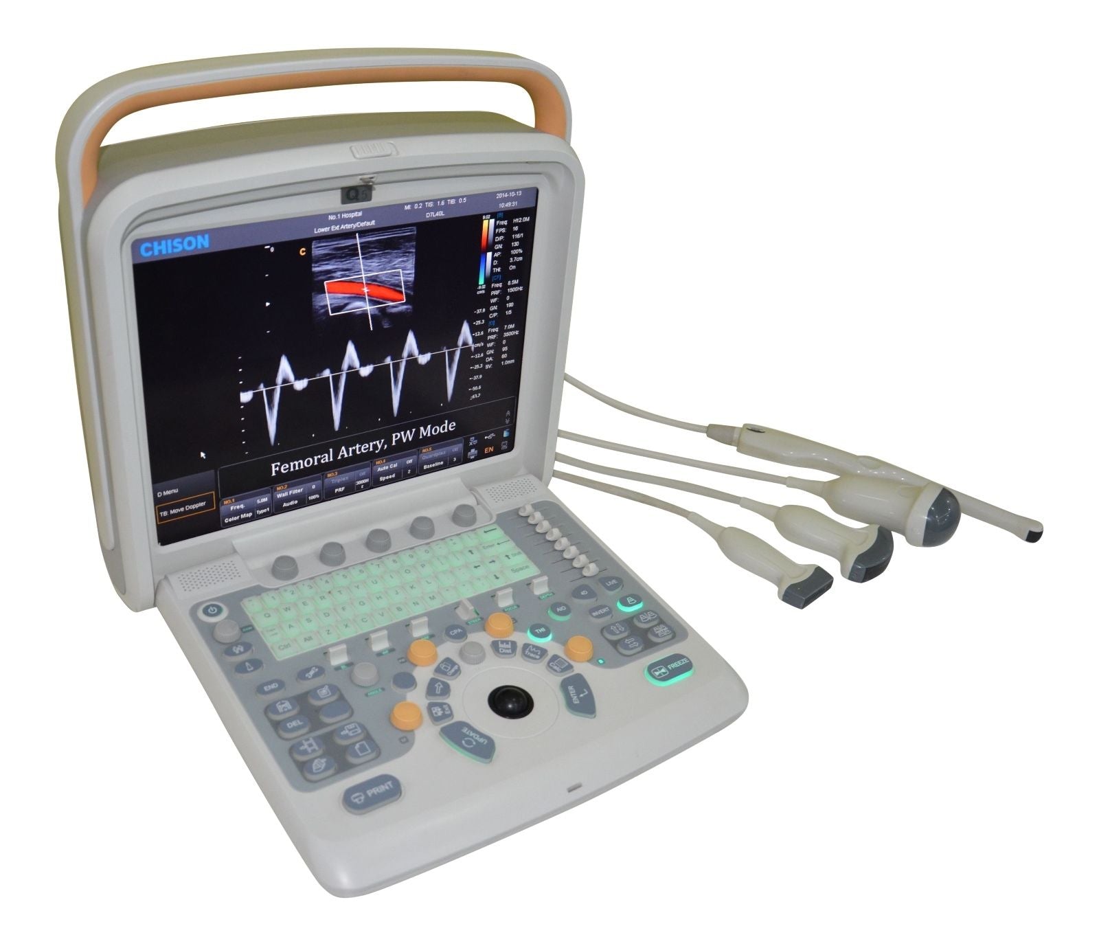 Chison Q5Vet Veterinary Color Doppler Ultrasound Machine-Equipment - Low Price DIAGNOSTIC ULTRASOUND MACHINES FOR SALE