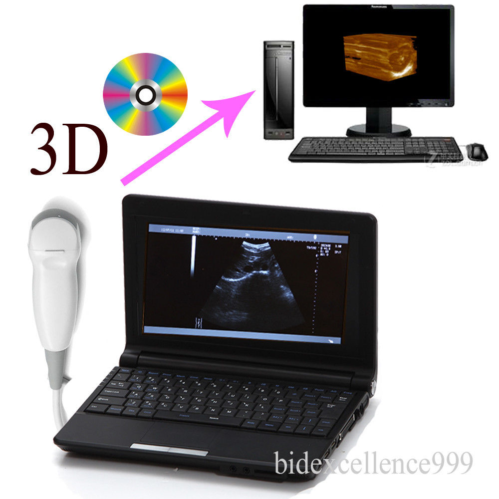 Top Full Digital Laptop Ultrasound Scanner Monitor+ Micro-Convex Probe 3D Image DIAGNOSTIC ULTRASOUND MACHINES FOR SALE