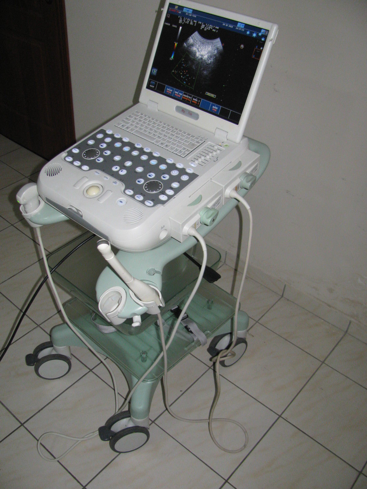 Esaote MyLabFive Ultrasound machine with cart and two probes(convex+vaginal) DIAGNOSTIC ULTRASOUND MACHINES FOR SALE
