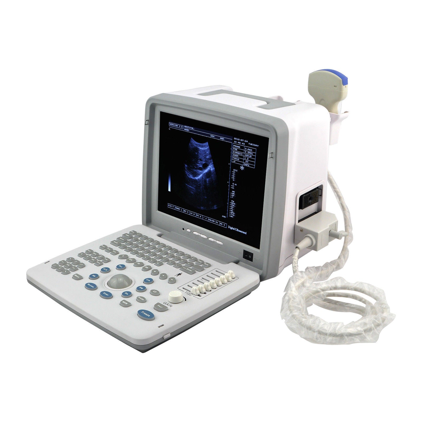 12-Inch Portable Digital Ultrasound Scanner Machine Convex Transvaginal 2 Probes DIAGNOSTIC ULTRASOUND MACHINES FOR SALE