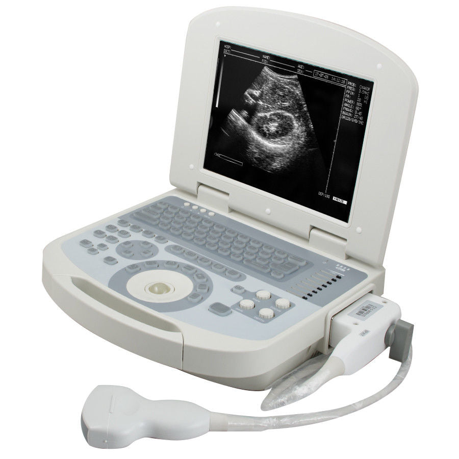 Portable Full Digital Laptop 10.4" Medical Ultrasound Scanner 3.5 Convex probe DIAGNOSTIC ULTRASOUND MACHINES FOR SALE