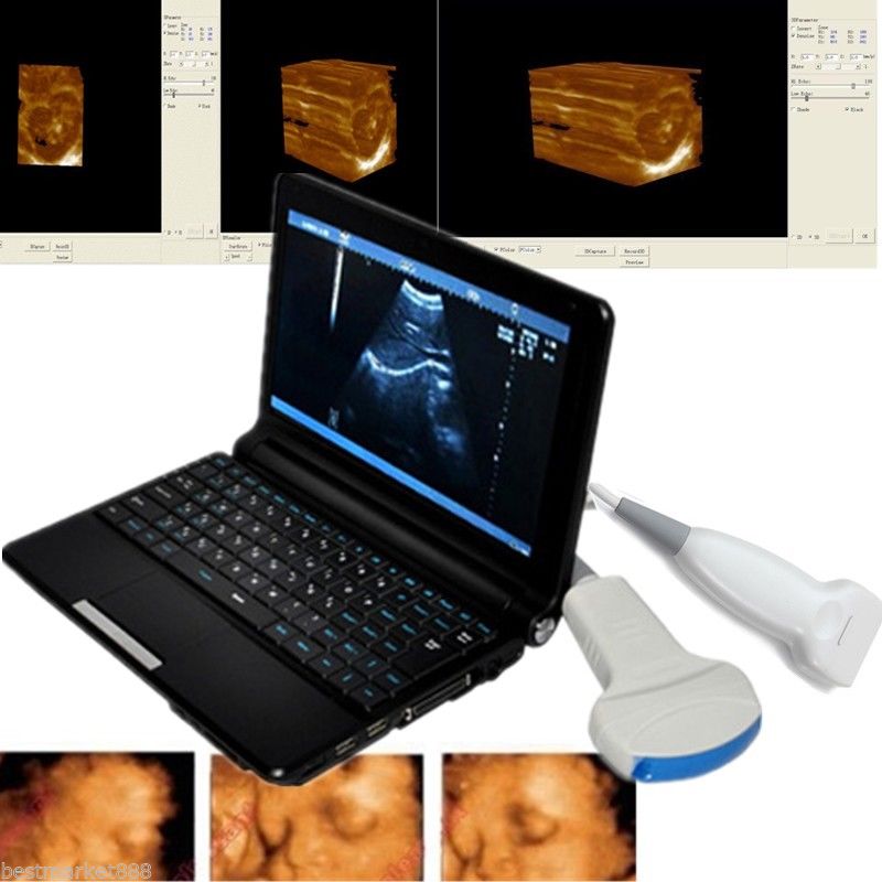 Top Digital Laptop Ultrasound Scanner PC System Convex Linear Probes 3D Version 190891763723 DIAGNOSTIC ULTRASOUND MACHINES FOR SALE