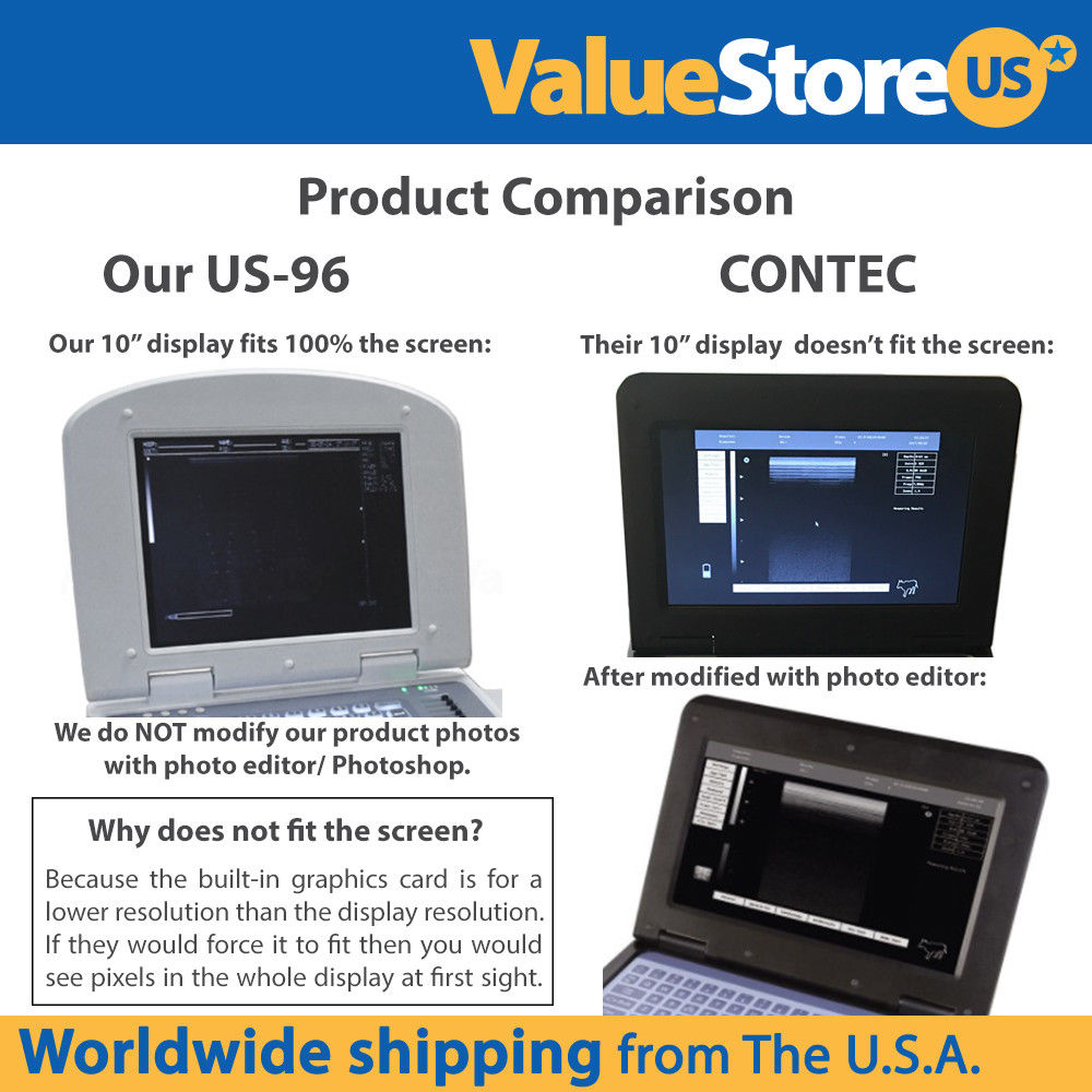 Portable Laptop Ultrasound Scanner US-96 with 3.5 MHz Convex Probe DIAGNOSTIC ULTRASOUND MACHINES FOR SALE