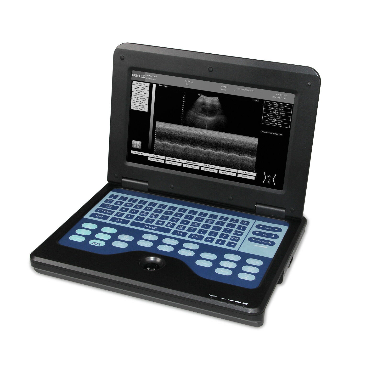 USA Seller,Digital Ultrasound Scanner Portable Laptop Ultrasound Machine+Convex DIAGNOSTIC ULTRASOUND MACHINES FOR SALE