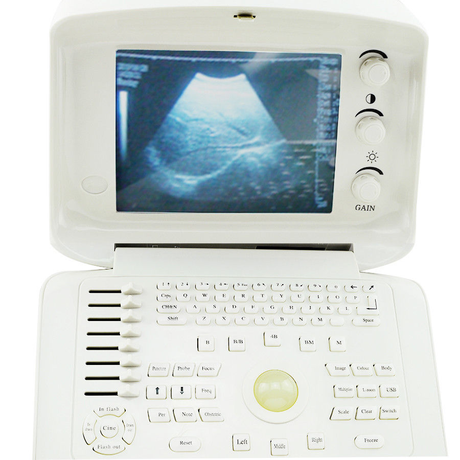 Ultrasound Scanner Portable Monitor Machine 7.5MHz Linear Probe Gift 3D Image CE 190891468420 DIAGNOSTIC ULTRASOUND MACHINES FOR SALE