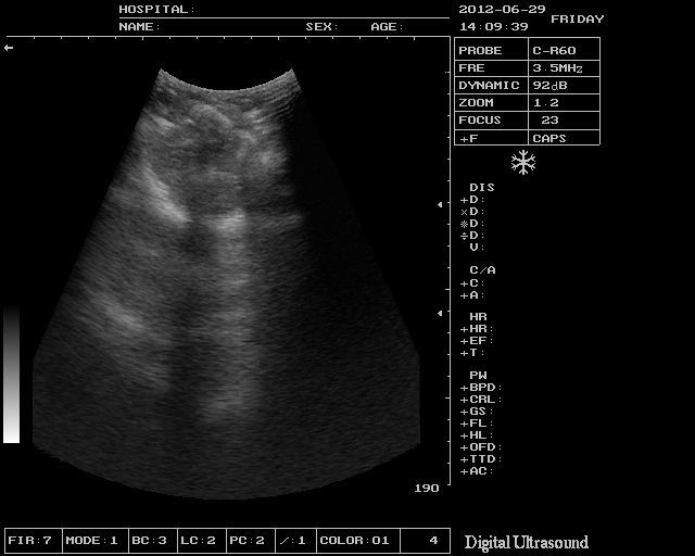 Top Full Digital Laptop Ultrasound Scanner Monitor+ Micro-Convex Probe 3D Image DIAGNOSTIC ULTRASOUND MACHINES FOR SALE