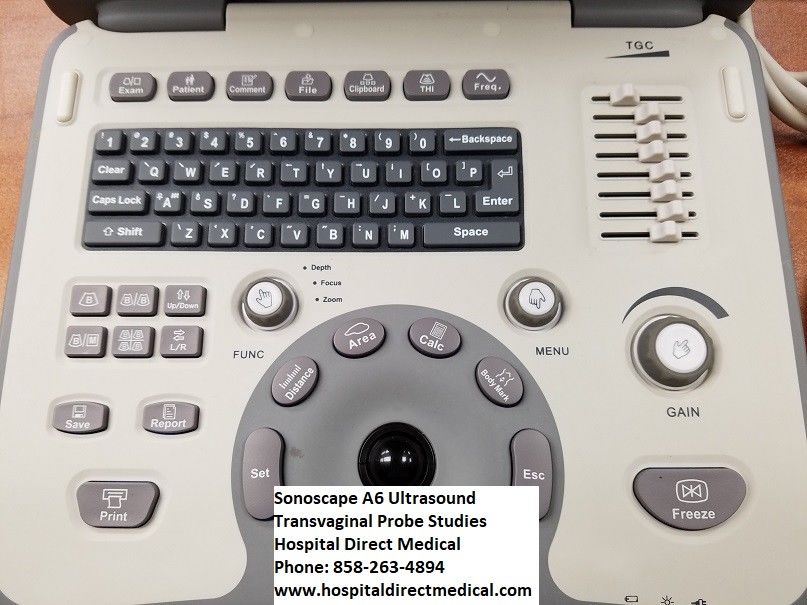 Sonoscape A6 Portable OBGYN Ultrasound with 2 Transducers DIAGNOSTIC ULTRASOUND MACHINES FOR SALE