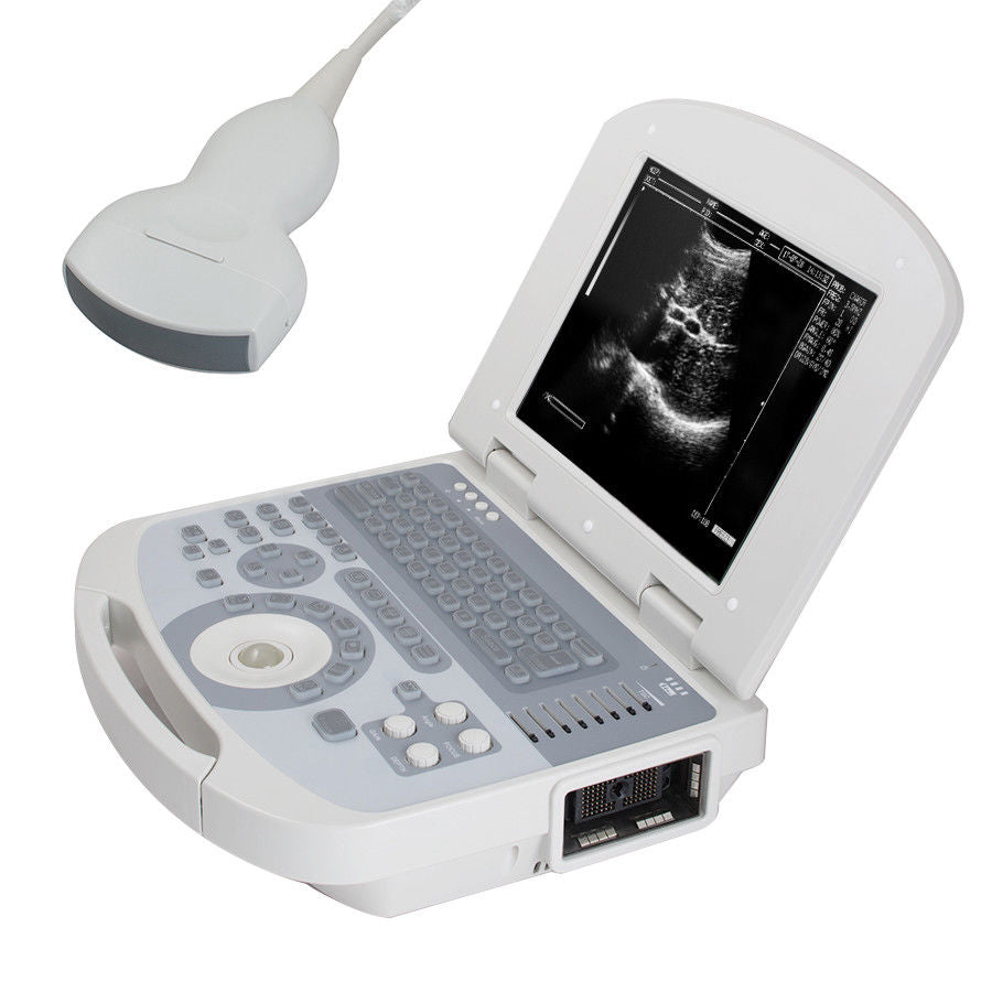 Portable 3D Digital Laptop Ultrasound Scanner Machine Convex Probe Abdominal USA 190891767165 DIAGNOSTIC ULTRASOUND MACHINES FOR SALE