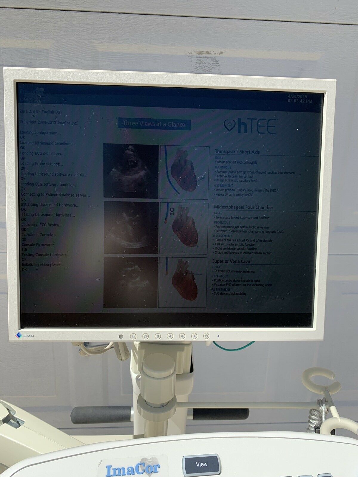 ImaCor Hemodynamic Ultrasound Machine Zura-1000 System w/ hTEE Software DIAGNOSTIC ULTRASOUND MACHINES FOR SALE