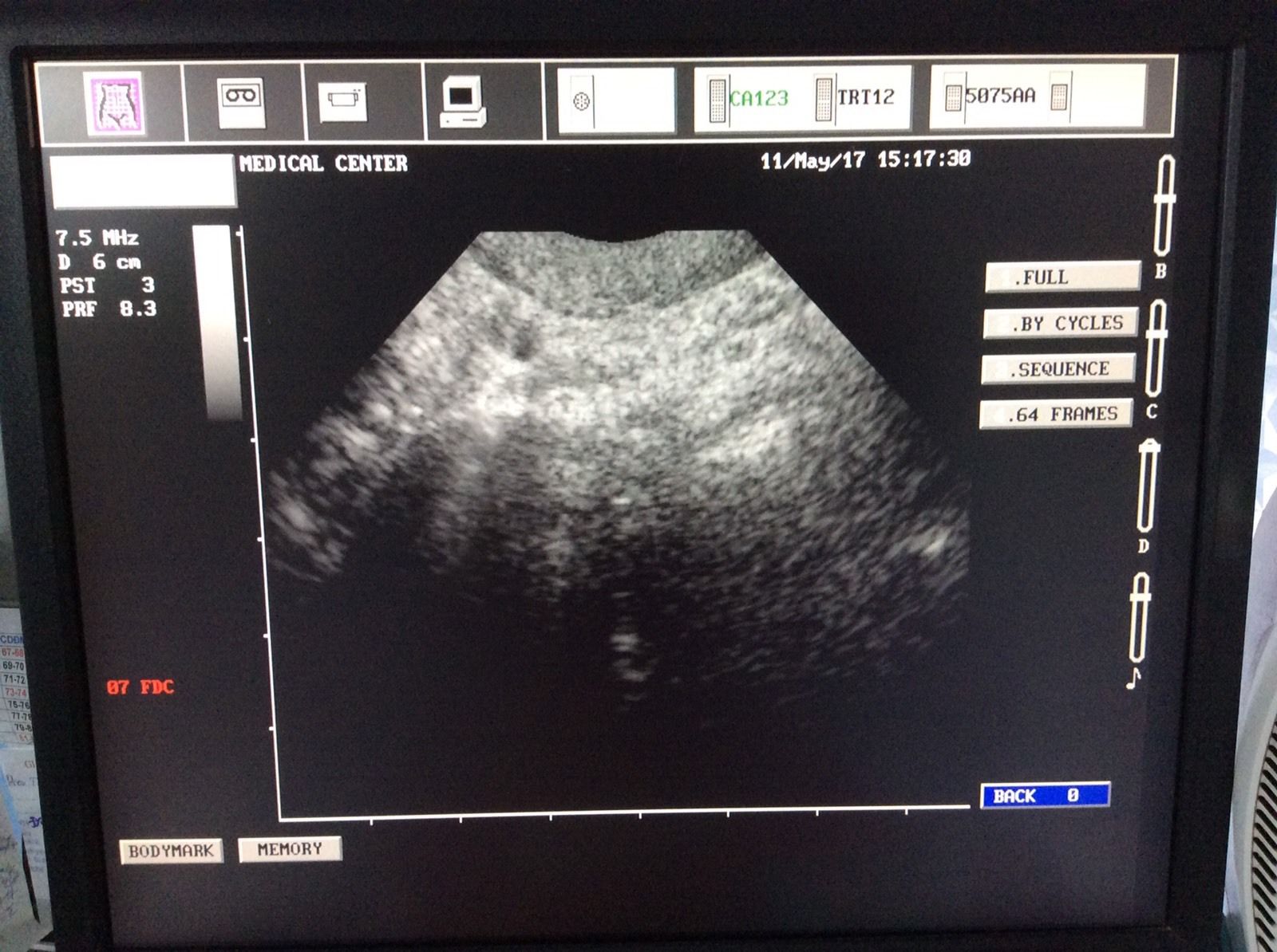 Esaote Biosound, MyLab ultrasound CA123 micro convex probe DIAGNOSTIC ULTRASOUND MACHINES FOR SALE