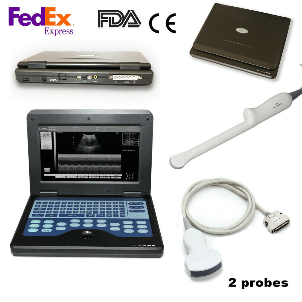 Portable Ultrasound Scanner Diagnostic Ultrasound Machine Convex+Transvaginal US DIAGNOSTIC ULTRASOUND MACHINES FOR SALE