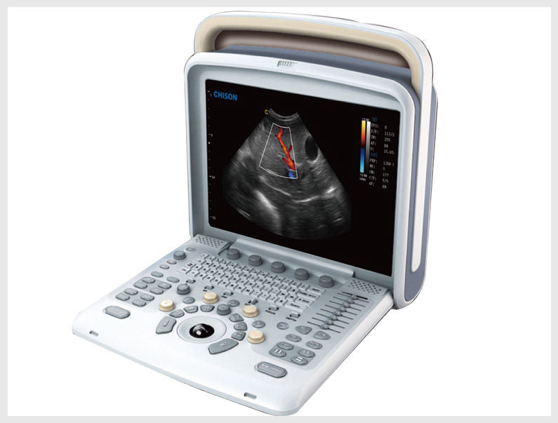Color Doppler Ultrasound Machine With One Probe Affordable Chison Q5 DIAGNOSTIC ULTRASOUND MACHINES FOR SALE