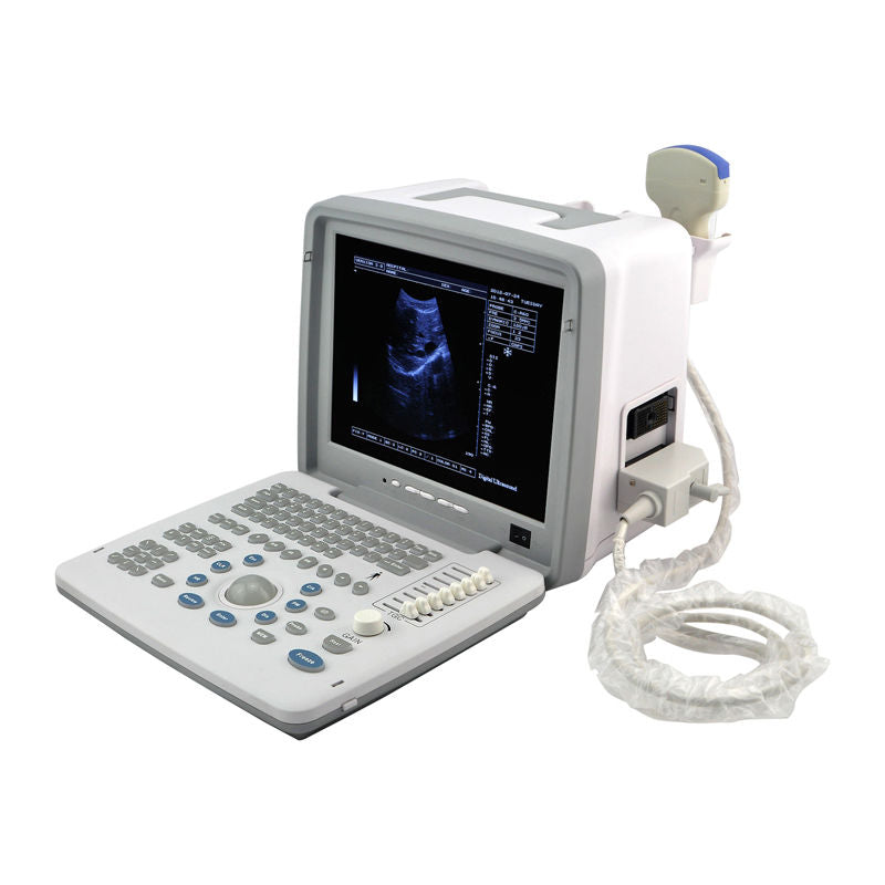 Kit Digital Ultrasound Machine Scanner System Convex +Linear Probe+Fetal Doppler 190891836625 DIAGNOSTIC ULTRASOUND MACHINES FOR SALE