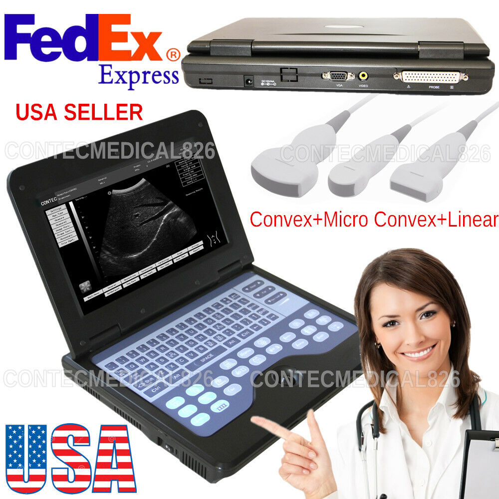 USA, Ultrasound Scanner Notebook Laptop Machine,3 Probes,Convex/Linear/Cardiac DIAGNOSTIC ULTRASOUND MACHINES FOR SALE