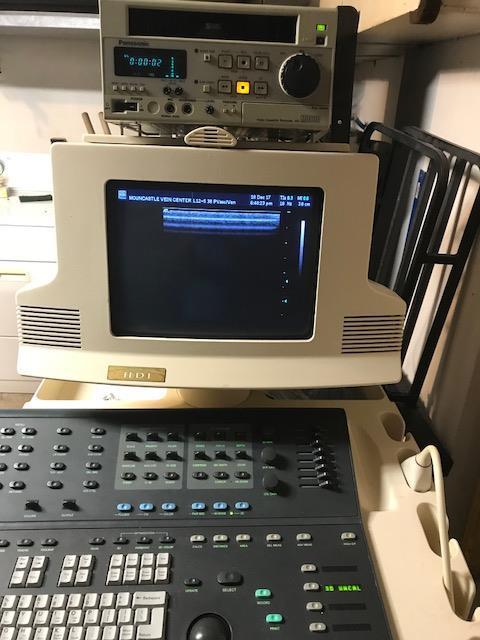 ATL HDI-3500 Diagnostic Ultrasound System w/1 Probe DIAGNOSTIC ULTRASOUND MACHINES FOR SALE