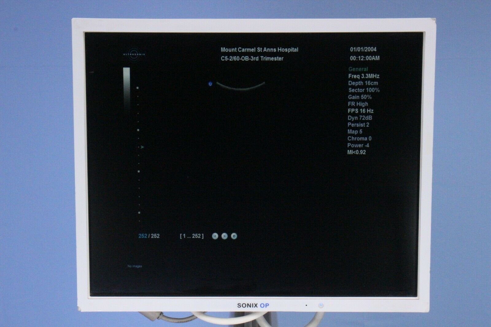 Ultrasonix Sonix OP Ultrasound with Two Probes, Printer, & Warranty!!  Tested!! DIAGNOSTIC ULTRASOUND MACHINES FOR SALE