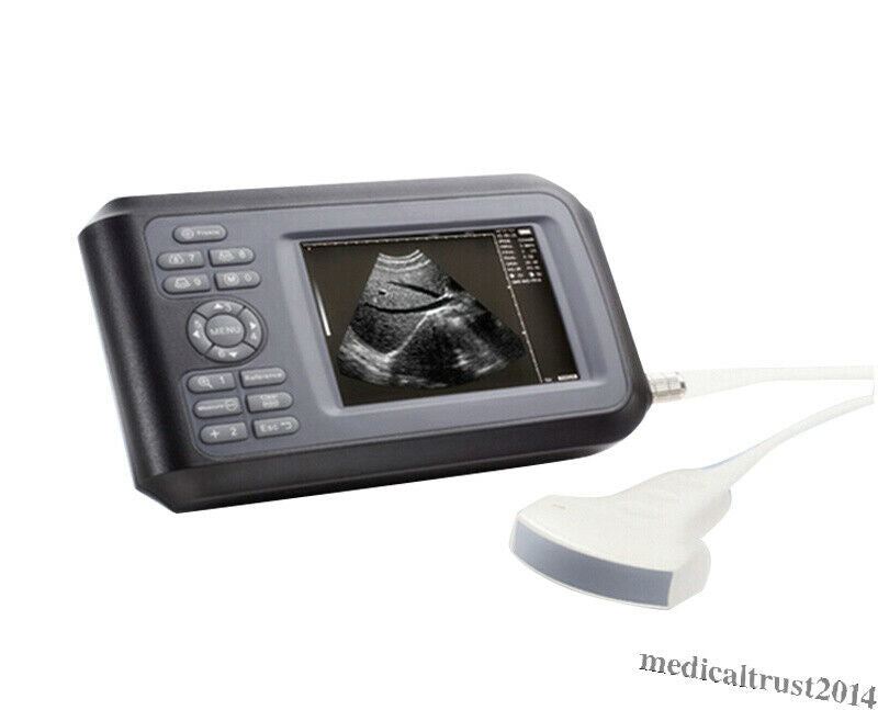 Portable Digital Handheld Human Ultrasound Scanner Machine 3.5mhz Convex Probe DIAGNOSTIC ULTRASOUND MACHINES FOR SALE