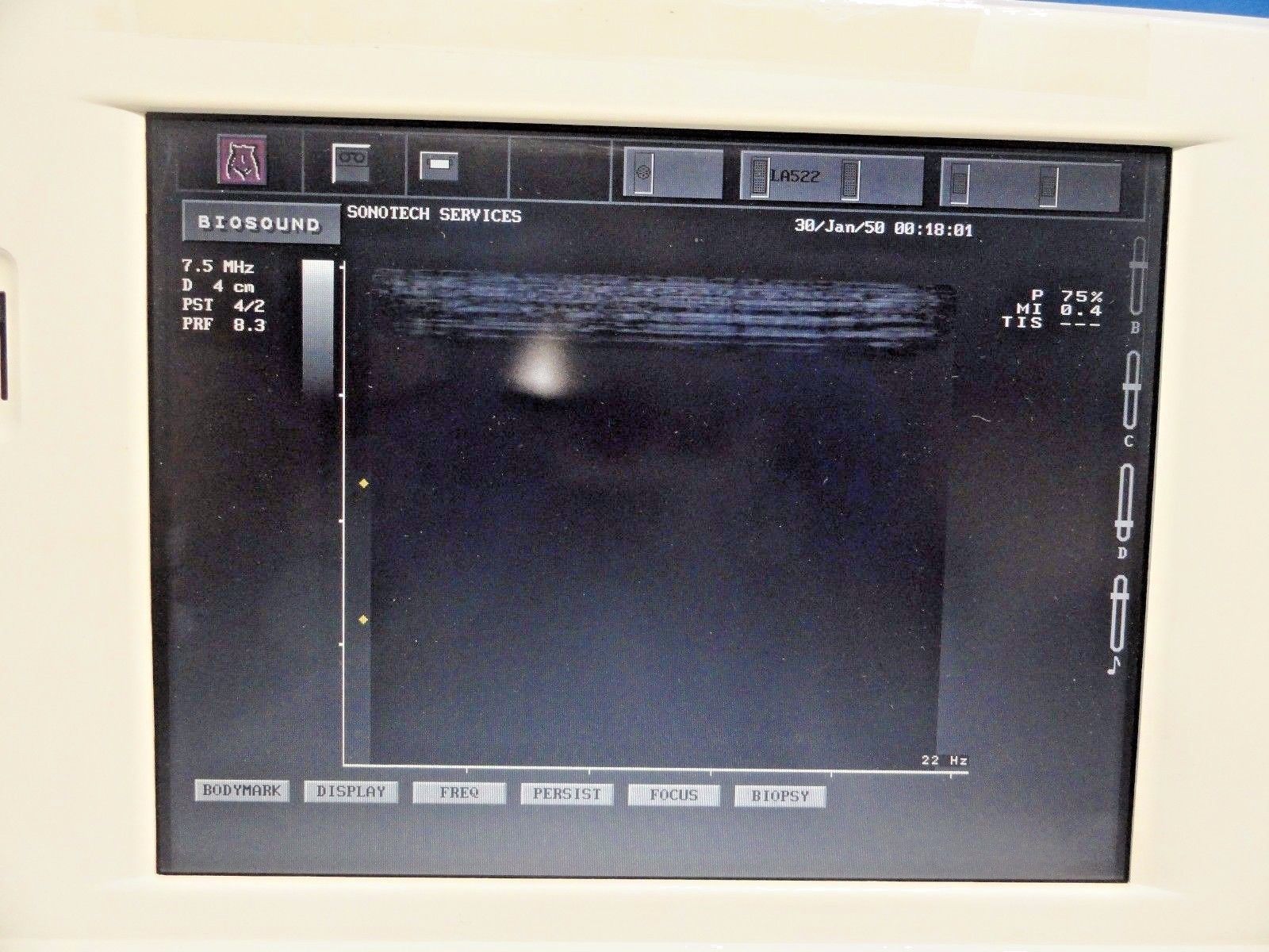 Biosound ESAOTE LA522E Linear Array Ultrasound Transducer for MyLab Series~13596 DIAGNOSTIC ULTRASOUND MACHINES FOR SALE