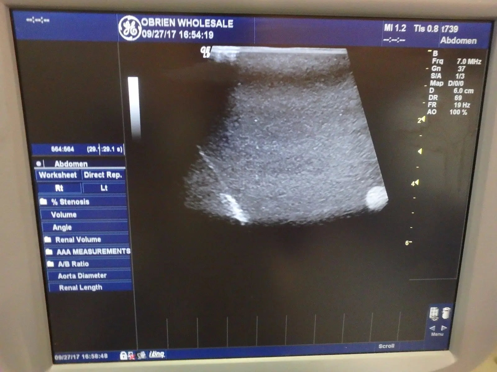 GE T739 Intraoperative 6.7/D5 0MHz Ultrasound Transducer Probe 2259244 Medical DIAGNOSTIC ULTRASOUND MACHINES FOR SALE