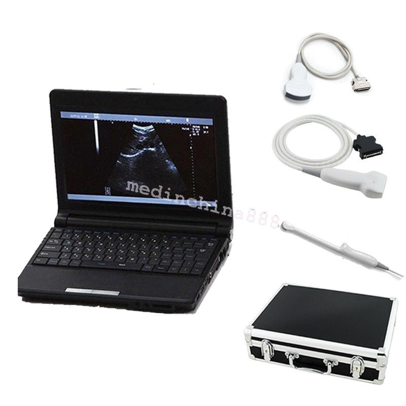 Clinc Laptop Ultrasound Scanner +Convex+Linear+Transvaginal 3 Probes +Free Box DIAGNOSTIC ULTRASOUND MACHINES FOR SALE