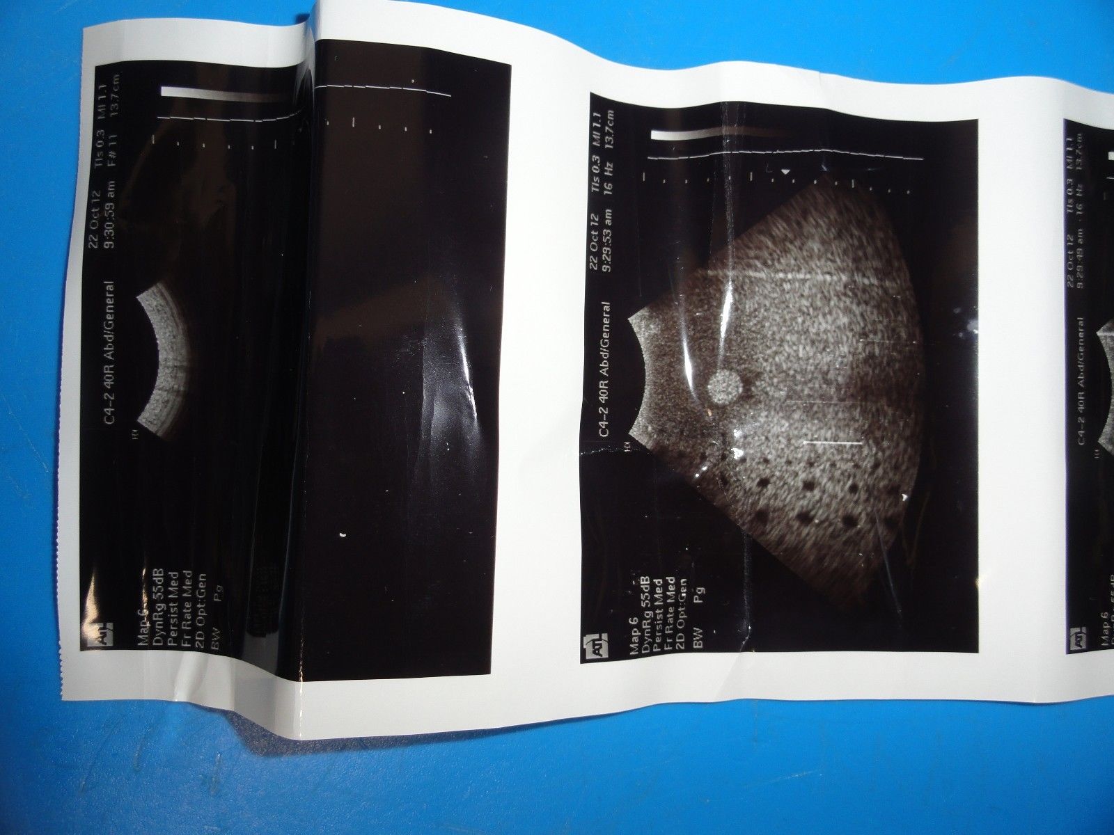 ATL AT3C42B / C4-2 Curved Array Broadband Probe (Abdominal OB/GYN General )6853 DIAGNOSTIC ULTRASOUND MACHINES FOR SALE