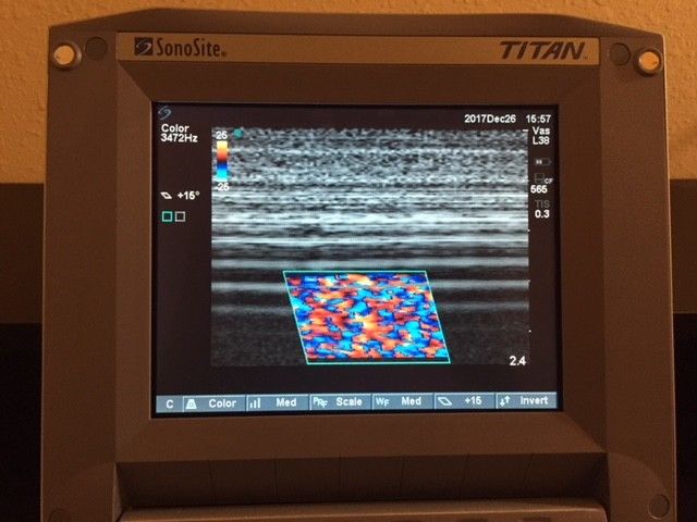 SonoSite Titan Portable Ultrasound Tested with Probe, Charger & New OEM Battery DIAGNOSTIC ULTRASOUND MACHINES FOR SALE