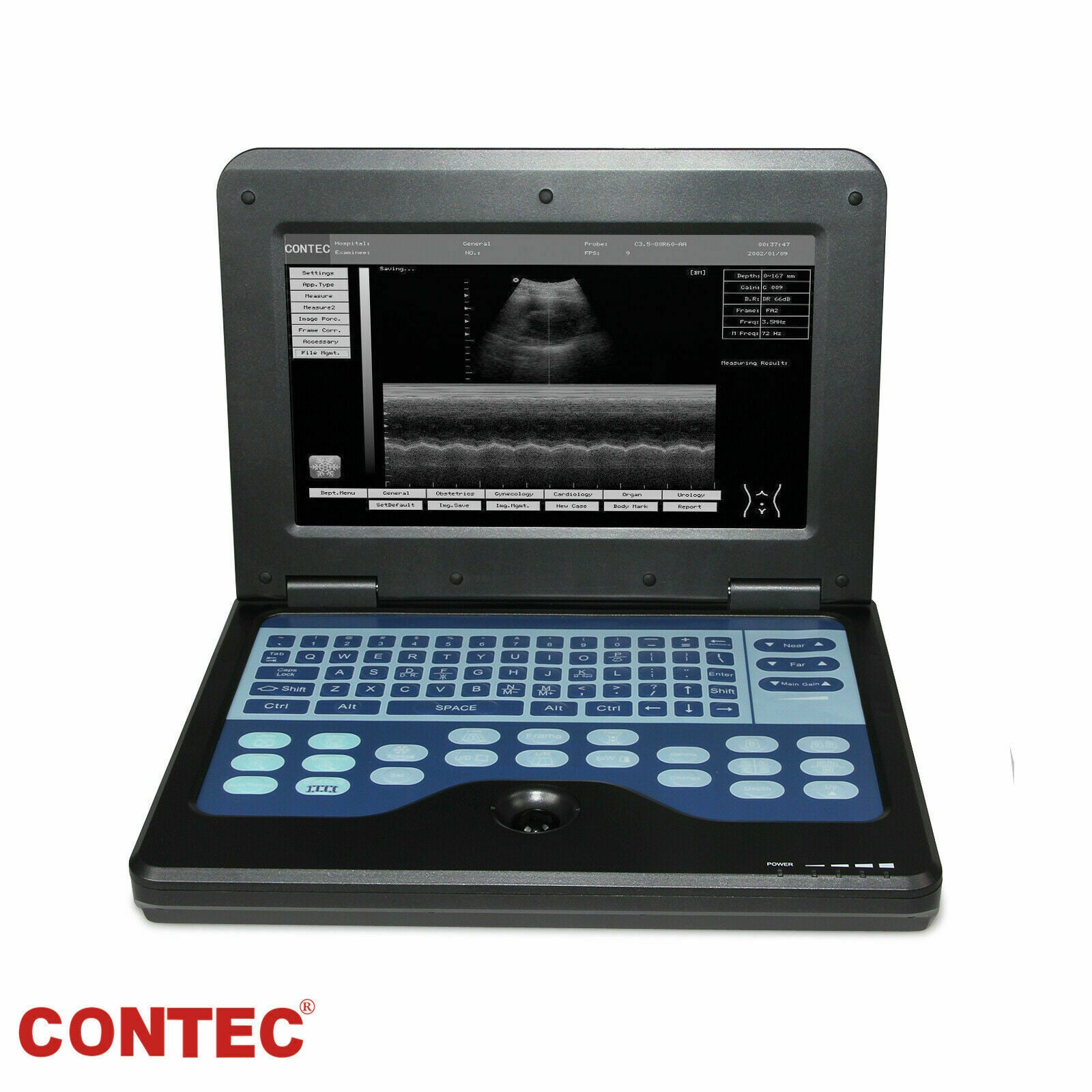 Digital Portable Ultrasound Machine Laptop Scanner with 2 Probes(Convex+Rectal） DIAGNOSTIC ULTRASOUND MACHINES FOR SALE