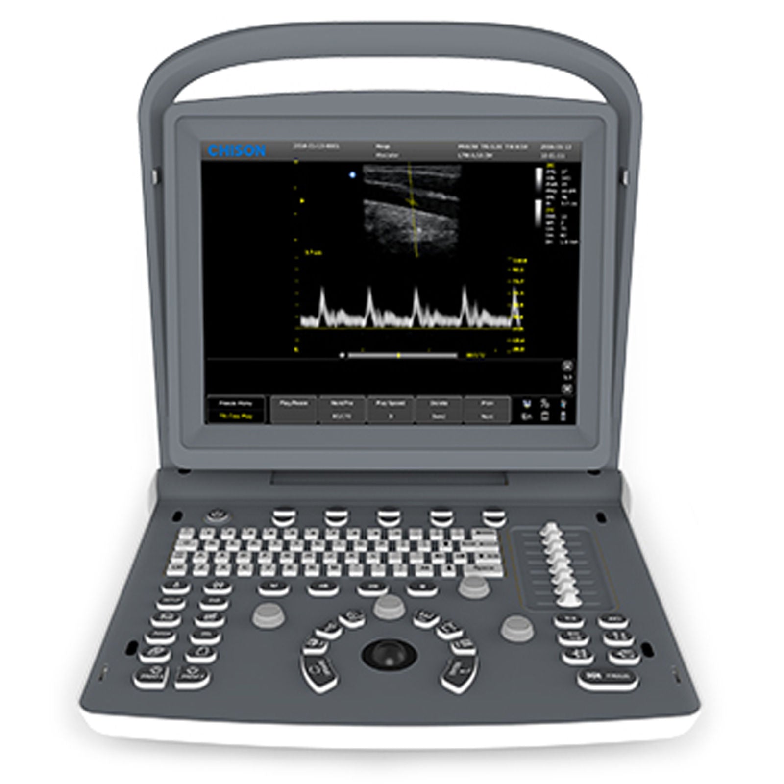 ECO2 Chison Portable Digital Ultrasound Scanner+3.5MHz ConvexProbe+CASE all d DIAGNOSTIC ULTRASOUND MACHINES FOR SALE