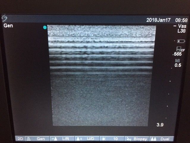 SonoSite Titan Portable Ultrasound Tested with Probe, Charger & New OEM Battery DIAGNOSTIC ULTRASOUND MACHINES FOR SALE