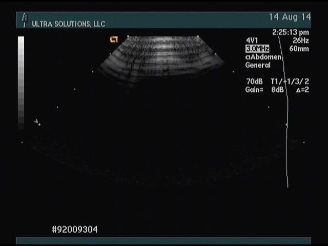 Siemens ACUSON 4V1 Ultrasound Transducer DIAGNOSTIC ULTRASOUND MACHINES FOR SALE