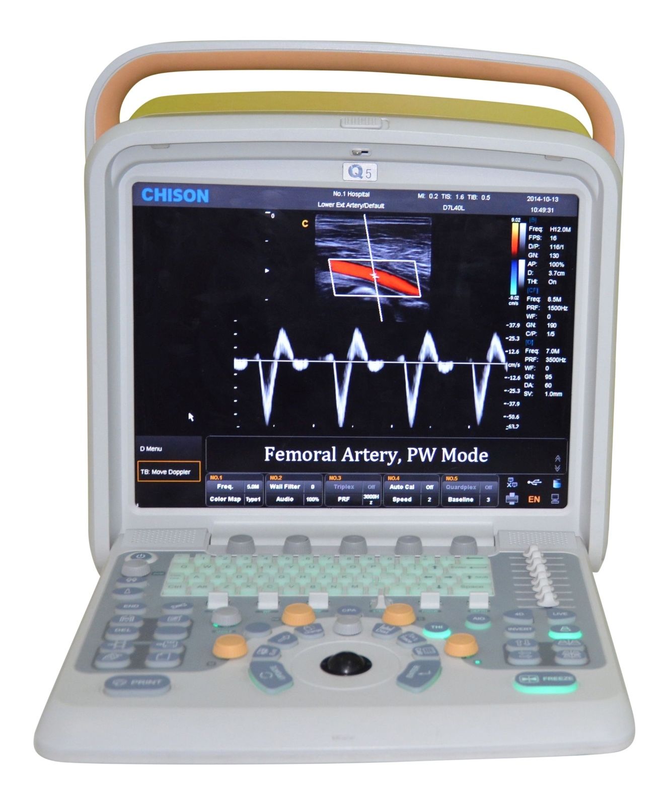 Chison Q5Vet Veterinary Color Doppler Ultrasound Machine-Equipment - Low Price DIAGNOSTIC ULTRASOUND MACHINES FOR SALE