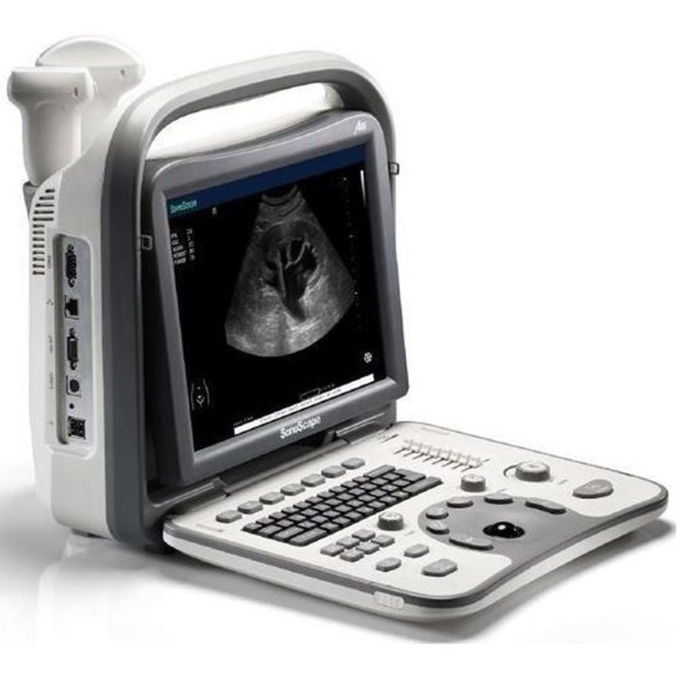 NEW! SonoScape A6 Portable Ultrasound Scanner Machine System + Laptop Style DIAGNOSTIC ULTRASOUND MACHINES FOR SALE