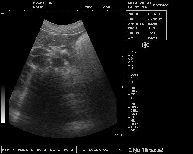 Ultrasound Scanner Machine 7.5Mhz Linear Probe Free 3D modul Vascular Scan Fast 190891351487 DIAGNOSTIC ULTRASOUND MACHINES FOR SALE