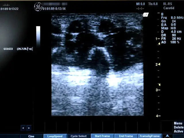 GE LOGIQ BOOK XP  ULTRASOUND WITH  3-PROBE DIAGNOSTIC ULTRASOUND MACHINES FOR SALE