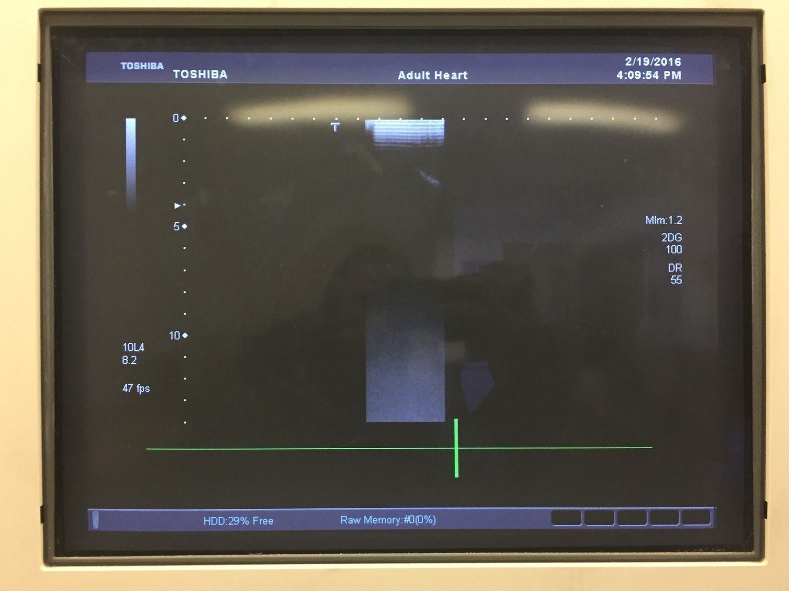 Toshiba Linear 6.0MHz PLT-604AT Ultrasound Transducer for Peripheral Vascular DIAGNOSTIC ULTRASOUND MACHINES FOR SALE