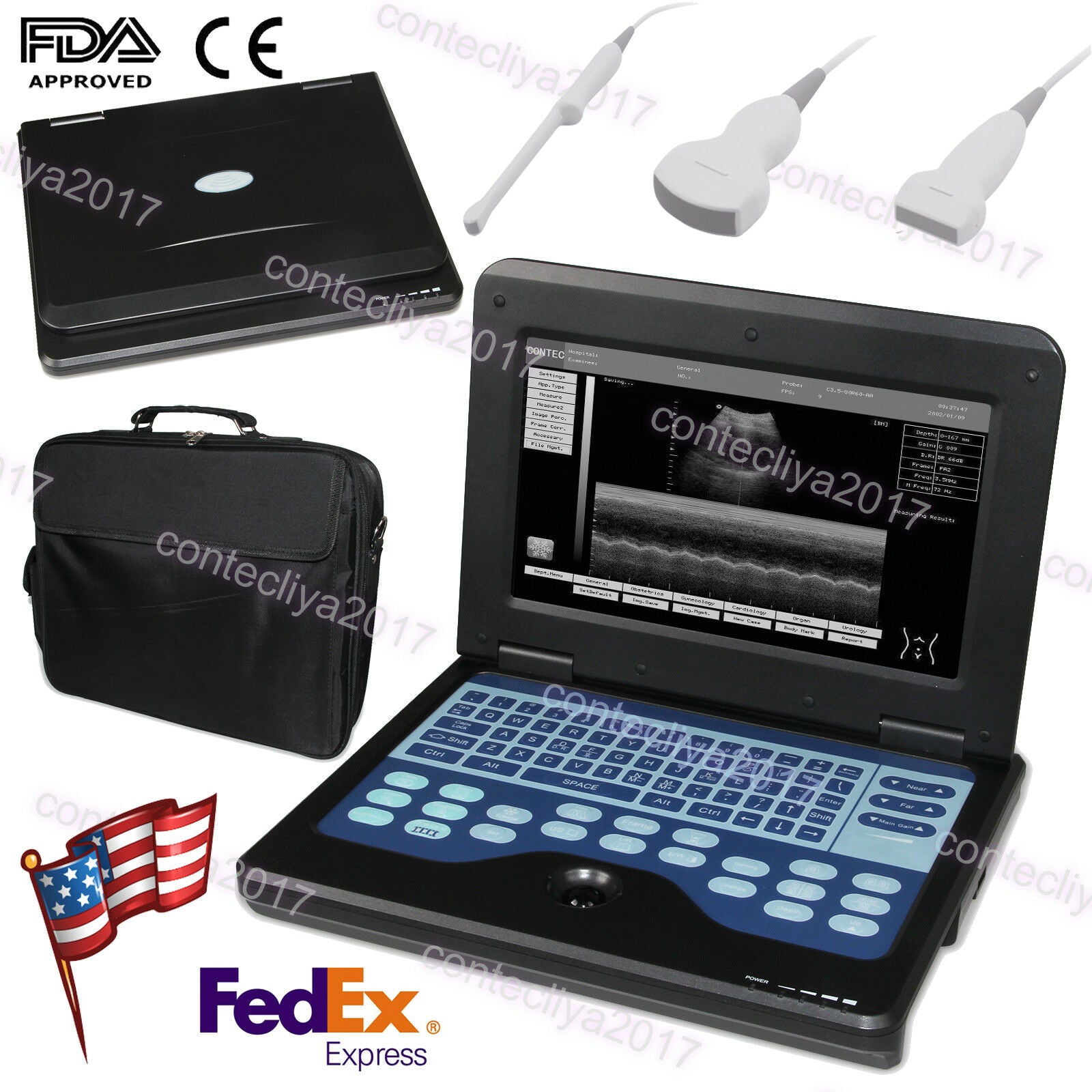 USA,Portable Ultrasound Scanner Laptop Machine Convex/Linear/Cardiac/Tranvaginal DIAGNOSTIC ULTRASOUND MACHINES FOR SALE