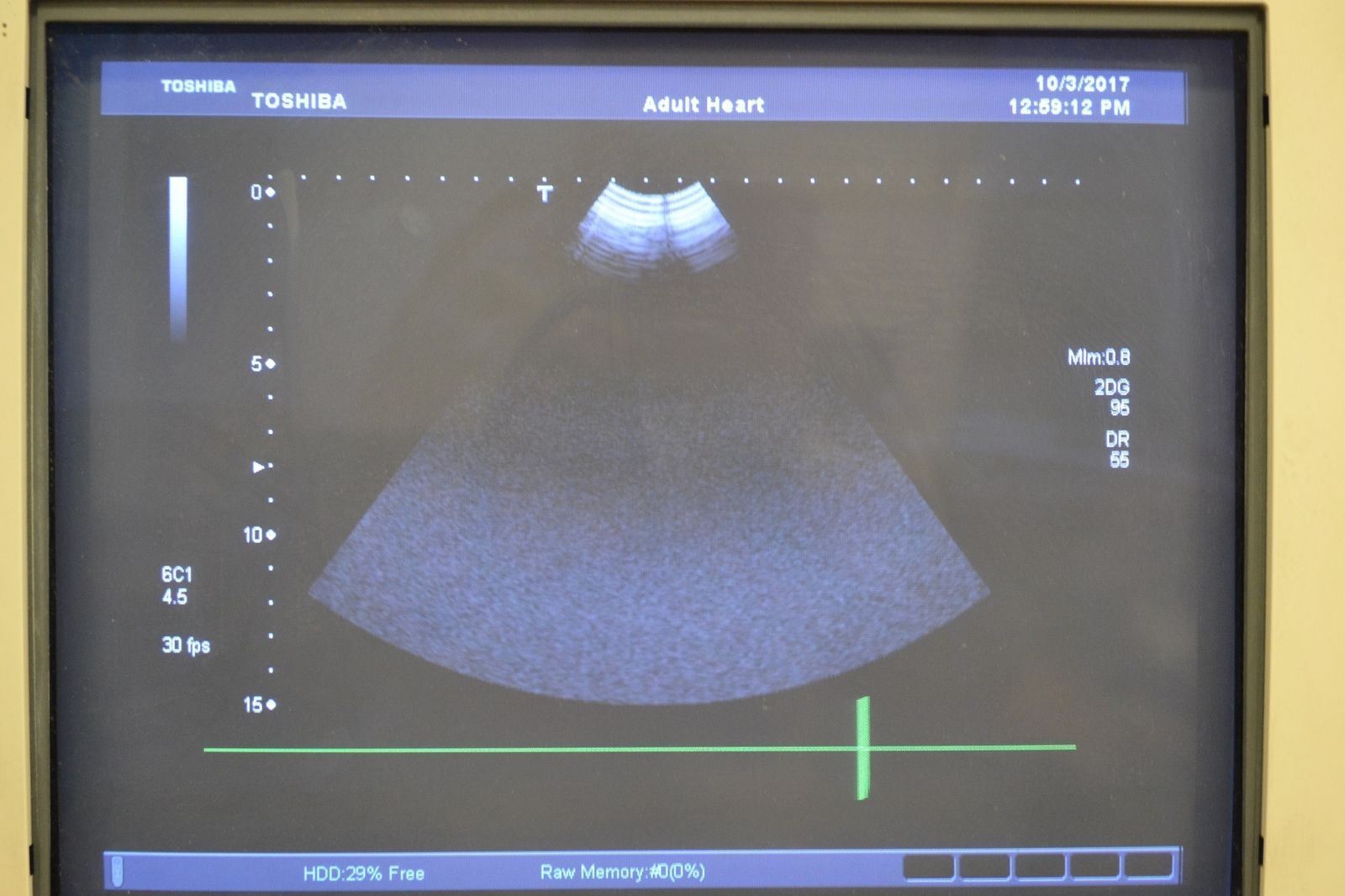 Toshiba Viamo PVT-382BT 5.5-1.8MHz Convex Ultrasound Transducer Probe J1632 DIAGNOSTIC ULTRASOUND MACHINES FOR SALE