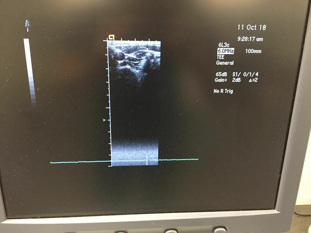 Siemens Acuson Sequoia C512 Ultrasound Machine DIAGNOSTIC ULTRASOUND MACHINES FOR SALE