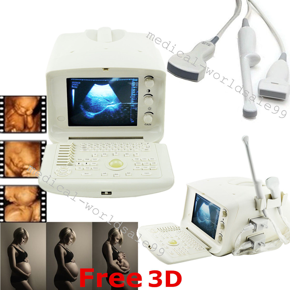 Ultrasonic System Ultrasound Scanner Machine 3 Probes/Convex/ Linear/vaginal 3D 190891376725 DIAGNOSTIC ULTRASOUND MACHINES FOR SALE