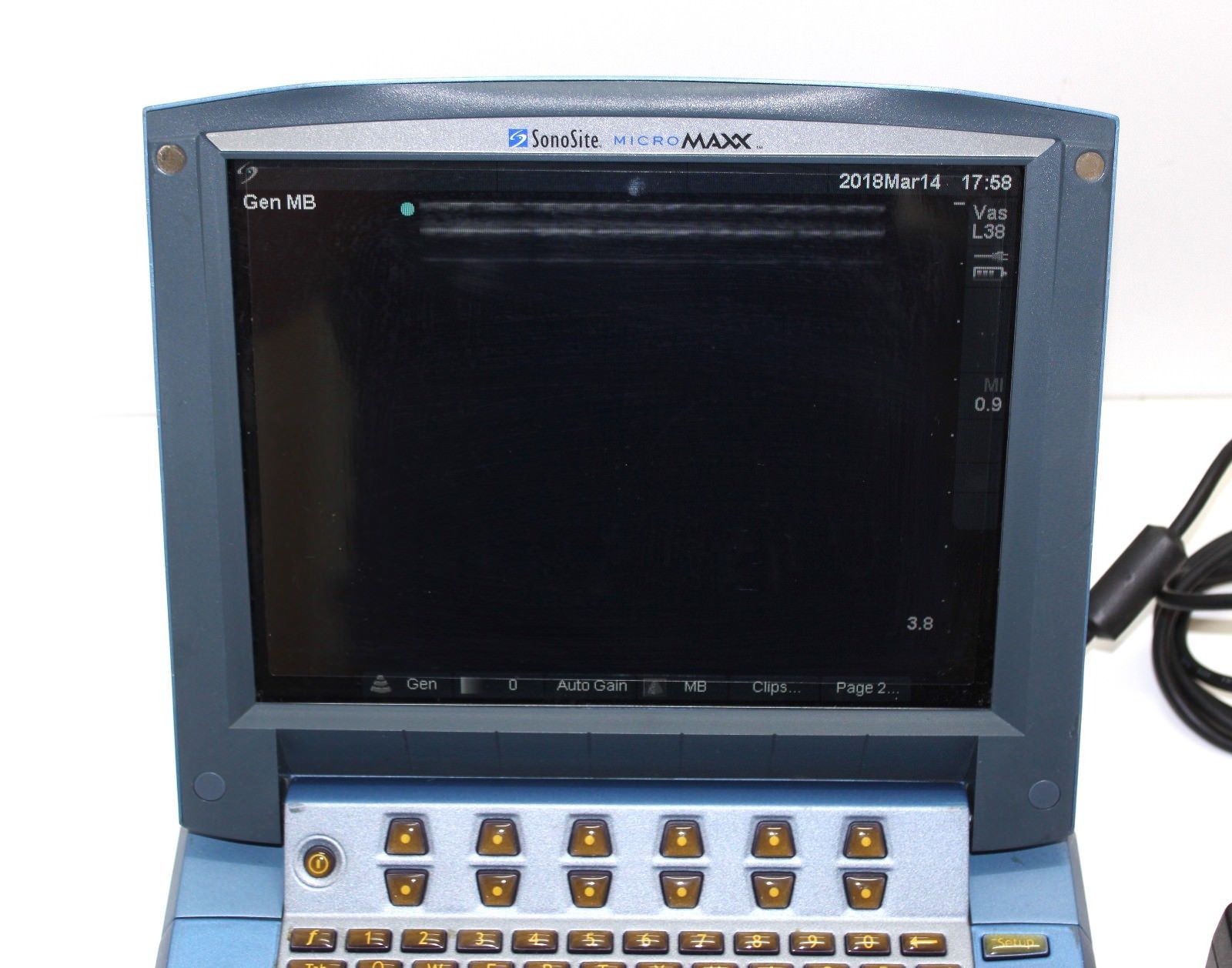 Sonosite Micromaxx Ultrasound ( please read) DIAGNOSTIC ULTRASOUND MACHINES FOR SALE