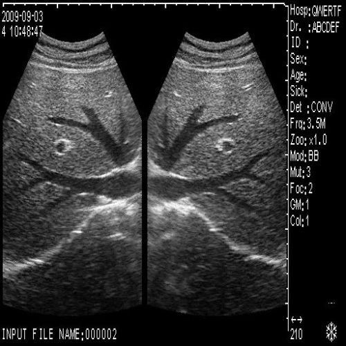 Clinic Diagnostic Ultrasound Scanner Machine Convex Probe +Transvaginal Probe 3D 190891054135 DIAGNOSTIC ULTRASOUND MACHINES FOR SALE