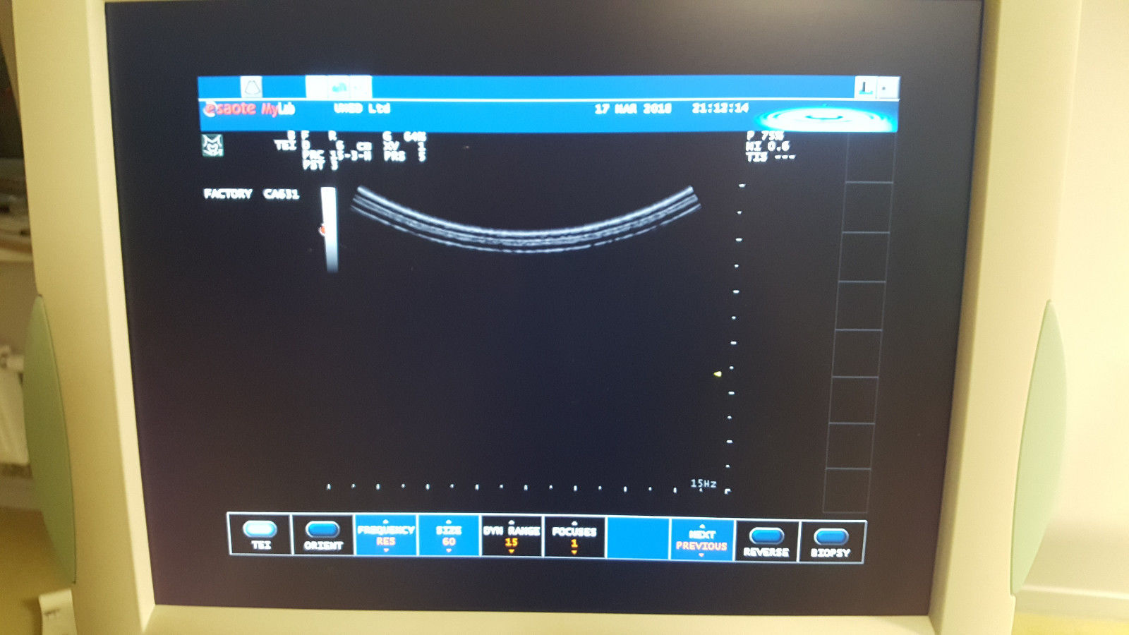 Biosound / Esaote MyLab 40 Diagnostic Ultrasound unit OB / GYN DIAGNOSTIC ULTRASOUND MACHINES FOR SALE