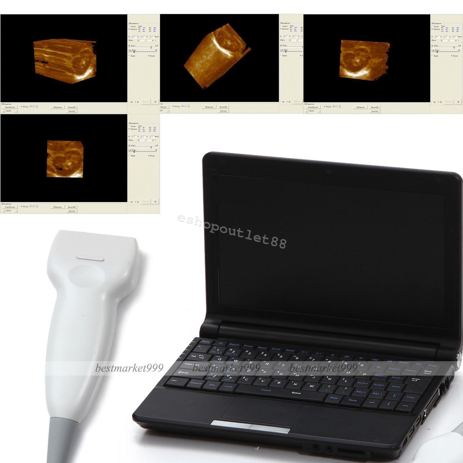 CE Full Digital Laptop Ultrasound Scanner with Linear probe +Free 3D 9000F Model DIAGNOSTIC ULTRASOUND MACHINES FOR SALE